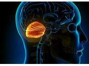Diferencias estructurales Cerebelo relacionan Autismo