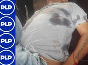 Delincuencia sigue dando hora norte chico…