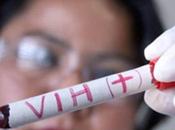 DENUNCIA. Chile, ausente encuentros internacionales prevención VIH/SIDA.