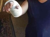 Indignante, usan disminuídos psíquicos para atacar israelíes