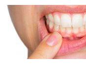 ¿Puede diabetes afectar dientes causar enfermedad encías?