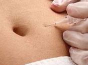 Carboxiterapia