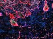 Defectos Proteína ASTN2 conducen trastornos Neurodesarrollo