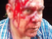 Turista alemana Cuba parte cabeza cubano extintor