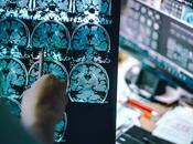 nuevas drogas pueden capaces tratar Alzheimer antes comience
