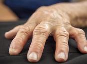 ¿Cuáles signos síntomas artritis reumatoide?
