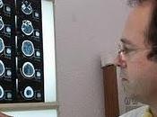 seis señales alarma ictus cerebral