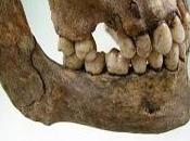 Huesos dientes: "Chivatos" edad