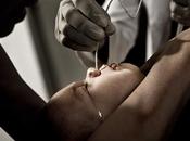 desarrolla primer escala para medir dolor niños edad preverbal