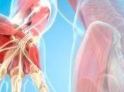 Artritis reumatoide gota: síntomas causas