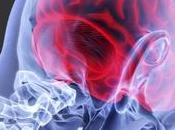 ictus también afecta jóvenes