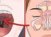 Aliviar congestión nasal