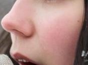 Trucos para cuidar piel invierno