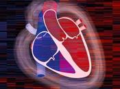Miocardiopatía hipertrófica obstructiva: causas, síntomas tratamiento
