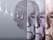 Artricenter: ¿Tener Artritis Reumatoide reduce riesgo desarrollar Alzheimer?