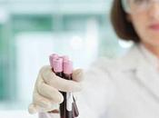 ¿Podría usted anémica? síntomas anemia mujeres