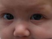 Vacuna contra varicela, mejor dosis