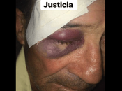 Joven cubana pide justicia para hombre golpeó brutalmente