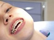 Ortodoncia infantil invisible: alternativas braquets