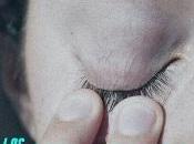 Dentelladas adolescente