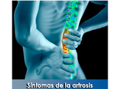 Artricenter: Síntomas artrosis vertebral “espondiloartrosis”