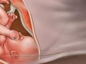 semanas embarazo Noveno