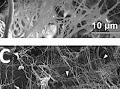 Compuesto Nanofibra-hidrogel permitira regenerar tejidos blandos