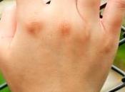 Vuestras consultas: “encerrado mismo”