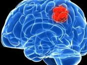 Tumor cerebral