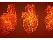 ¿Porque Cardiomiopatía Hipertrófica induce Muerte Repentina?