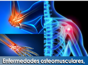 Artricenter: Enfermedades osteomusculares, diagnóstico.