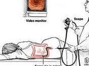 consiste colonoscopia?