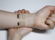 ¿Que Parches Grafeno?