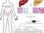 Vinculan Bacterias Intestinales Hígado Graso Alcohólico