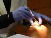 Ventajas tratamiento ortodoncia invisible, informa Clínica dental Díaz Frontera