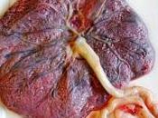 Placenta puede proporcionar información Clinica Crítica