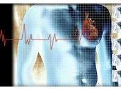 Estadificación choque cardiogénico identifica riesgo mortalidad