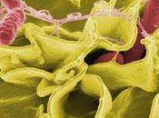 Salmonella typhimurium invadiendo células humanas cultivo