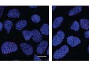 Vinculan crecimiento cerebro autismo daño
