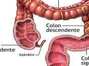 Consejos para evitar cáncer colon