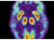 Astrocitos toman formas distintas Corteza Cerebral