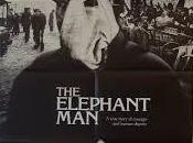 hombre elefante 1980 David Lynch (PELÍCULA HISTORIA REAL)