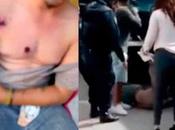 Policías Villa Zaragoza golpean persona discapacitada