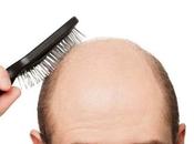 ¿Qué implante capilar dónde encontrar mejor clínica?