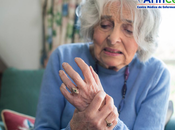 ¿Cómo saber apareció nueva crisis artritis reumatoide?