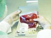 Ultiman procedimiento para detectar Alzheimer sangre