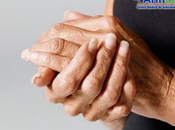 Artrosis manos ¿Cómo cuidarnos?