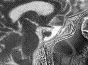 Física podría ayudar curar