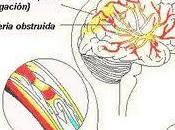 Factores riesgo para accidentes cerebrovasculares