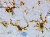 células inmunes cerebro pueden prevenir convulsiones
